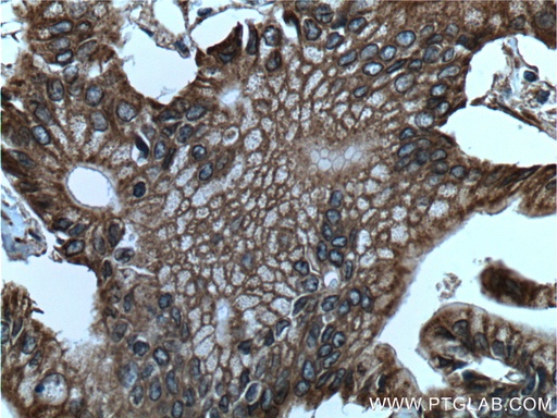 [21703-1-AP-20UL] Integrin Beta 6 Polyclonal antibody