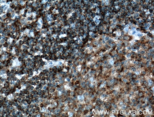 [21704-1-AP-20UL] HLA-DMB Polyclonal antibody