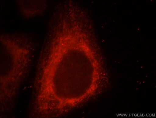 [21705-1-AP-150UL] UQCRC1 Polyclonal antibody