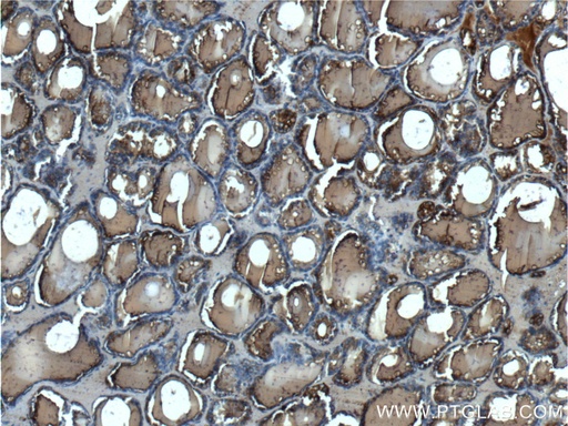 [21714-1-AP-150UL] Thyroglobulin Polyclonal antibody