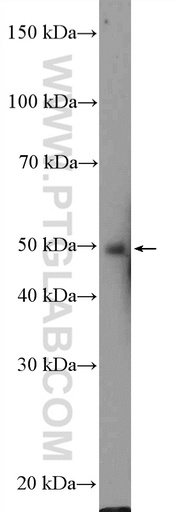 [21717-1-AP-150UL] ZIC3 Polyclonal antibody