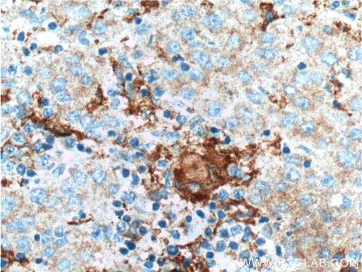 [21718-1-AP-20UL] PFKFB1 Polyclonal antibody