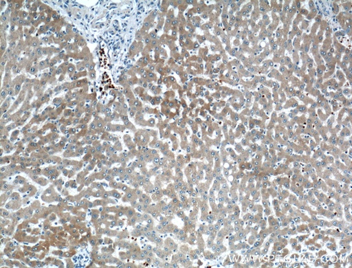 [21721-1-AP-20UL] CYP2A6 Polyclonal antibody