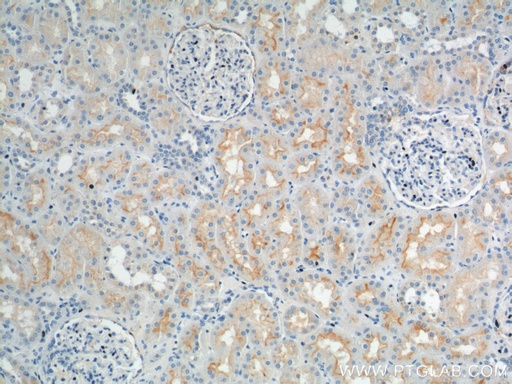 [21722-1-AP-20UL] SLC13A2 Polyclonal antibody