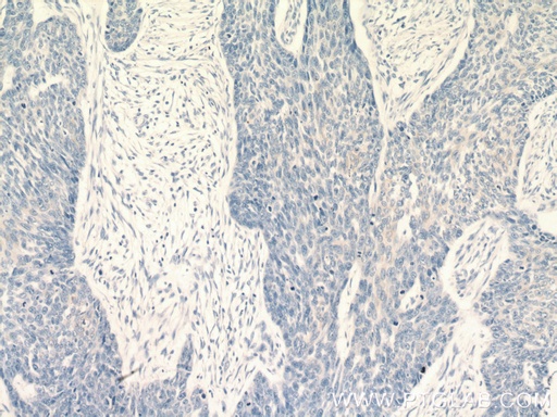 [21725-1-AP-20UL] KRT2 Polyclonal antibody