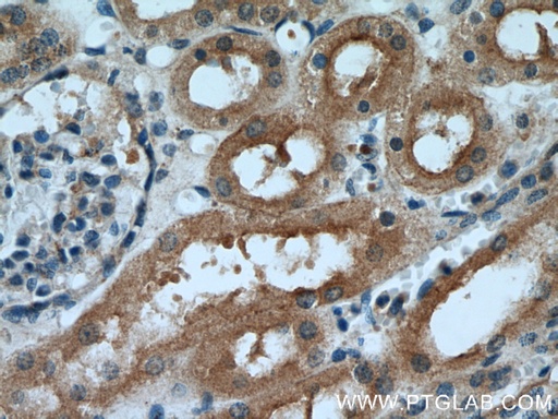 [21728-1-AP-150UL] IDE Polyclonal antibody