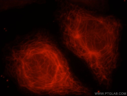 [21733-1-AP-150UL] KANK2 Polyclonal antibody