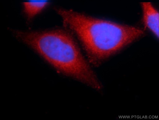 [21741-1-AP-20UL] CARD11 Polyclonal antibody