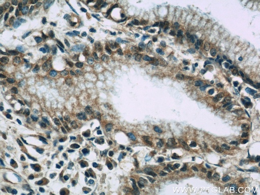 [21745-1-AP-150UL] VNN1 Polyclonal antibody