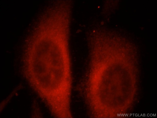 [21746-1-AP-150UL] RAPGEFL1 Polyclonal antibody
