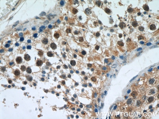 [21748-1-AP-150UL] APC1 Polyclonal antibody