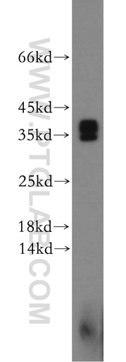 [21751-1-AP-150UL] Synaptogyrin-4 Polyclonal antibody