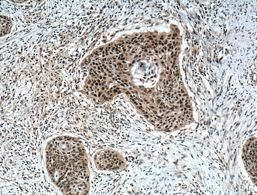[21752-1-AP-150UL] ZNF750 Polyclonal antibody