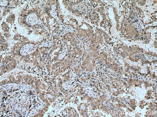 [21753-1-AP-150UL] RASSF7 Polyclonal antibody