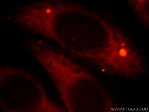 [21755-1-AP-150UL] HSPB2 Polyclonal antibody