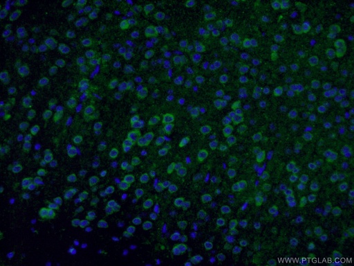 [21760-1-AP-150UL] GAD65 Polyclonal antibody