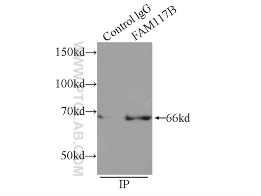 [21768-1-AP-20UL] FAM117B Polyclonal antibody