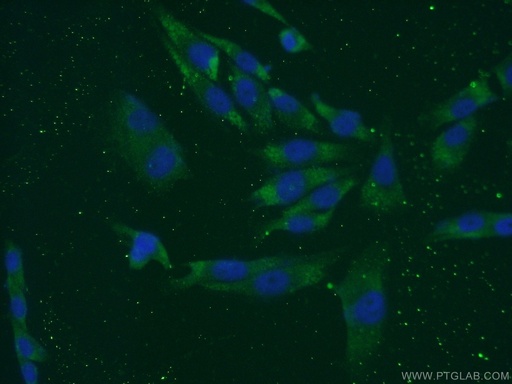 [21771-1-AP-20UL] LCE1B Polyclonal antibody