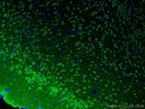 [21774-1-AP-20UL] L-VOCC Polyclonal antibody
