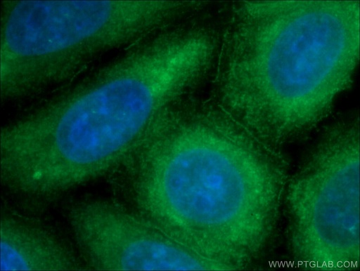 [21776-1-AP-150UL] Ataxin 2 Polyclonal antibody