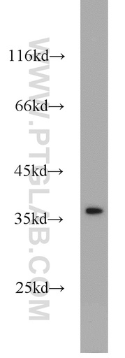 [21777-1-AP-150UL] TTF1; NKX2-1 Polyclonal antibody