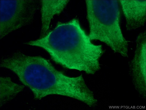 [21799-1-AP-20UL] LDHA Polyclonal antibody