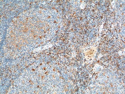 [21809-1-AP-20UL] CD52 Polyclonal antibody
