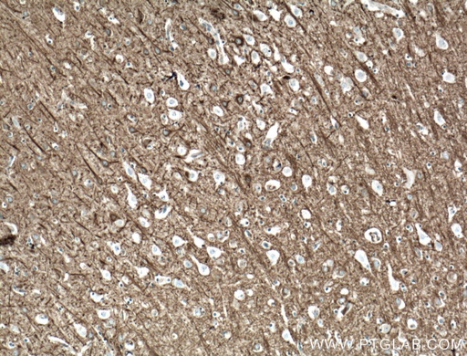 [21815-1-AP-20UL] CEP152 Polyclonal antibody