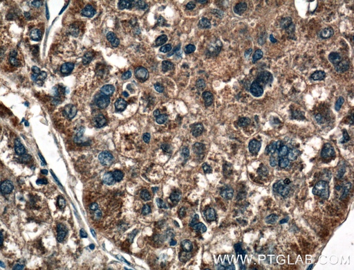 [21837-1-AP-20UL] MASP1 Polyclonal antibody