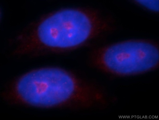 [21843-1-AP-150UL] ZNF74 Polyclonal antibody