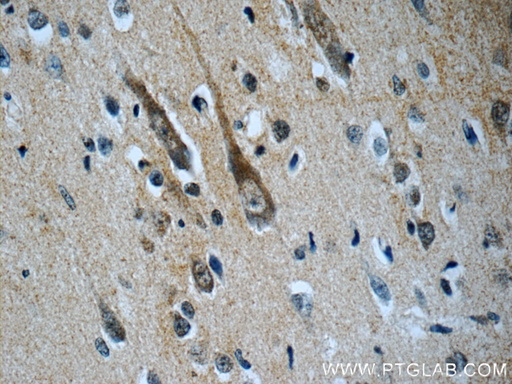 [21848-1-AP-20UL] CHT1 Polyclonal antibody