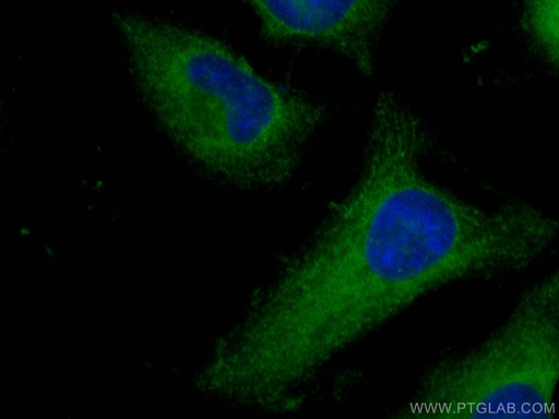 [21850-1-AP-20UL] ROCK1 Polyclonal antibody