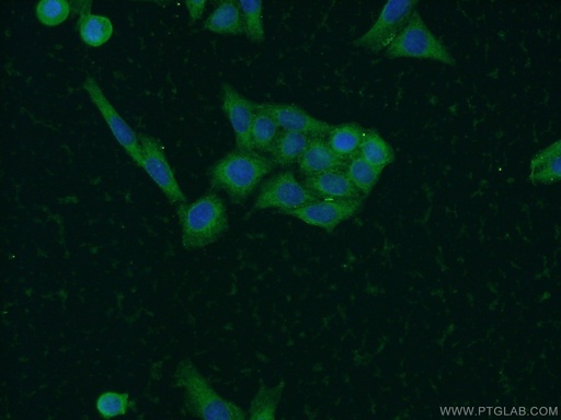[21852-1-AP-150UL] SOAT2 Polyclonal antibody