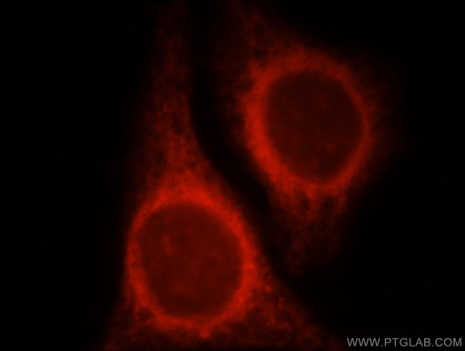 [21854-1-AP-150UL] NR3C2 Polyclonal antibody