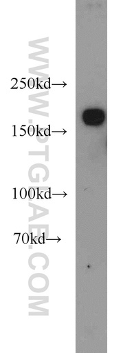 [21856-1-AP-20UL] KIDINS220 Polyclonal antibody