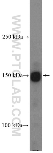 [21862-1-AP-20UL] Intersectin 1 Polyclonal antibody