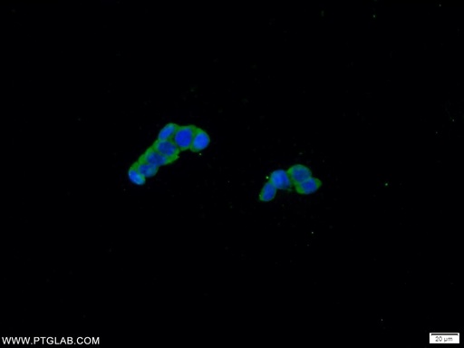 [21869-1-AP-20UL] CCHCR1 Polyclonal antibody