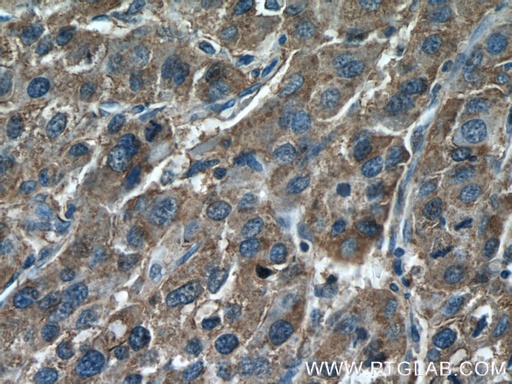 [21870-1-AP-20UL] DUS4L Polyclonal antibody