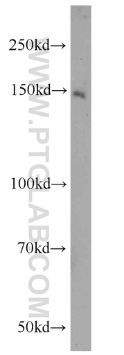 [21873-1-AP-150UL] ZNF541 Polyclonal antibody