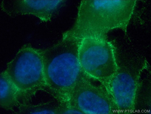 [21880-1-AP-20UL] DSG2 Polyclonal antibody