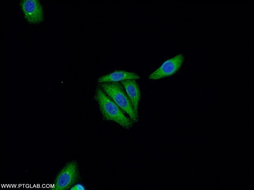 [21891-1-AP-20UL] P53 Polyclonal antibody