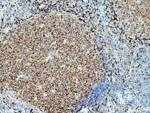 [21894-1-AP-150UL] CD22 Polyclonal antibody