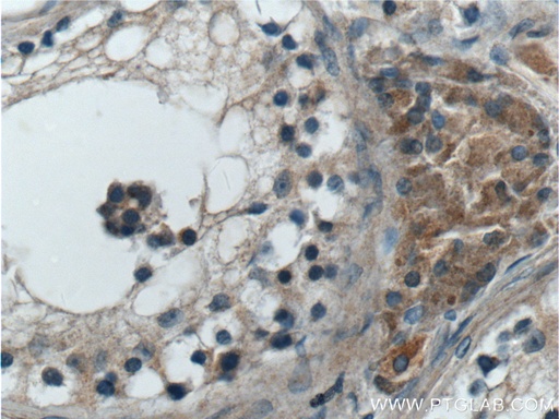 [21901-1-AP-20UL] ANO10 Polyclonal antibody