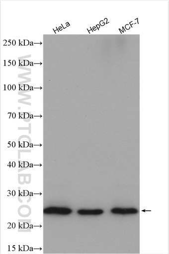 [21902-1-AP-150UL] TMED3 Polyclonal antibody