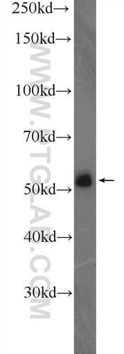 [21904-1-AP-150UL] DELE1 Polyclonal antibody