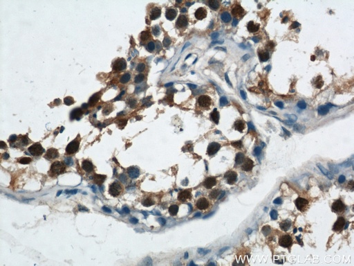 [21906-1-AP-20UL] ZBTB38 Polyclonal antibody