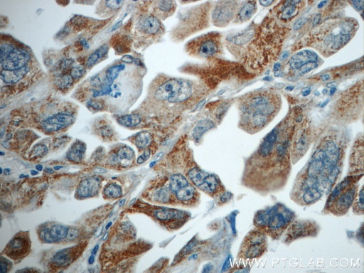 [21912-1-AP-150UL] TMEM139 Polyclonal antibody