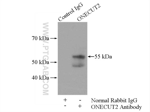 [21916-1-AP-150UL] ONECUT2 Polyclonal antibody