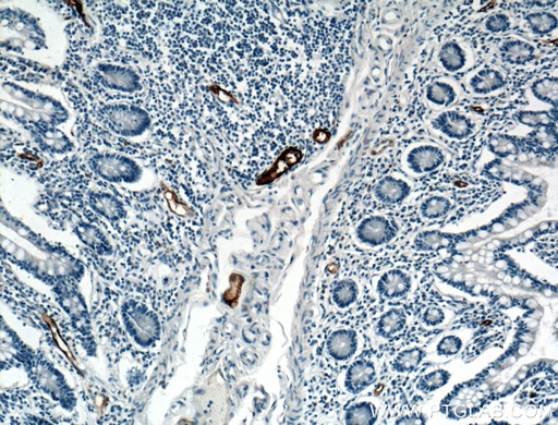 [21917-1-AP-150UL] MAdCAM1 Polyclonal antibody