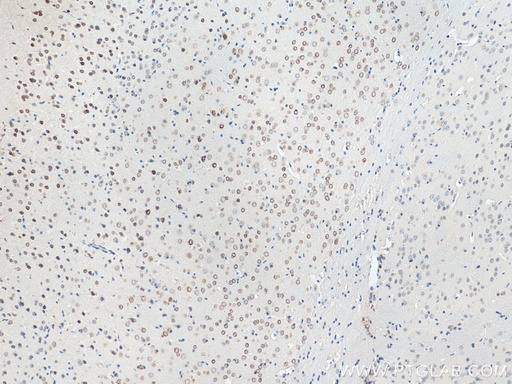 [21921-1-AP-20UL] VMA21 Polyclonal antibody
